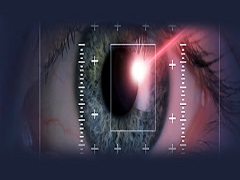 Acuidade Visual com Laser